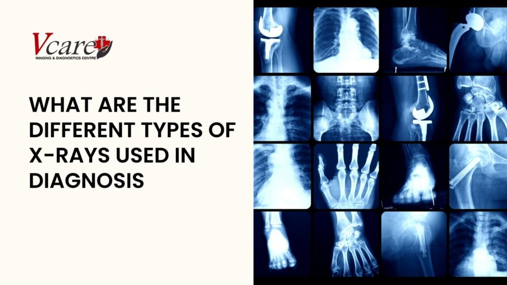 What are the different types of X-rays used in diagnosis?