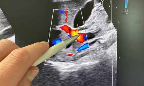 Best Imaging and Diagnostic Center in Kandivali Mumbai