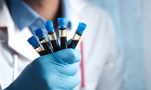 Best Imaging and Diagnostic Center in Kandivali Mumbai