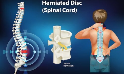 Best Imaging and Diagnostic Center in Kandivali Mumbai