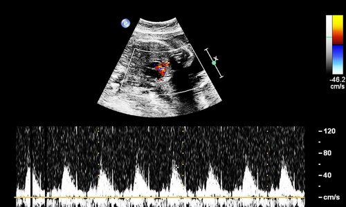 Best Imaging and Diagnostic Center in Kandivali Mumbai