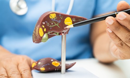 Best Imaging and Diagnostic Center in Kandivali Mumbai