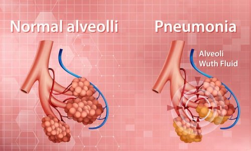 Best Imaging and Diagnostic Center in Kandivali Mumbai