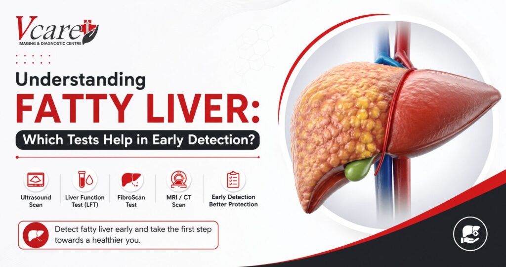 Understanding Fatty Liver: Which Tests Help in Early Detection?